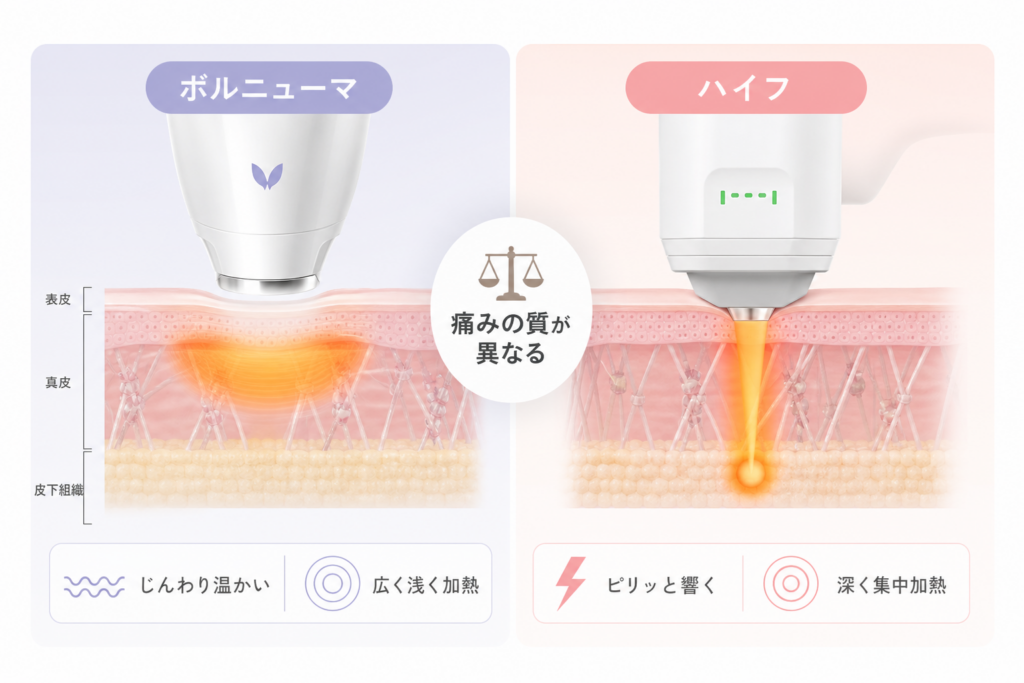 たるみ引き締め効果を狙うボルニューマとハイフの痛みの質的違い