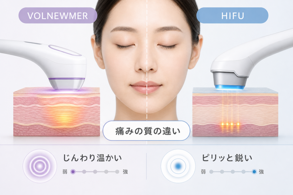 たるみ引き締め効果を狙うボルニューマとハイフの痛みの質的違い