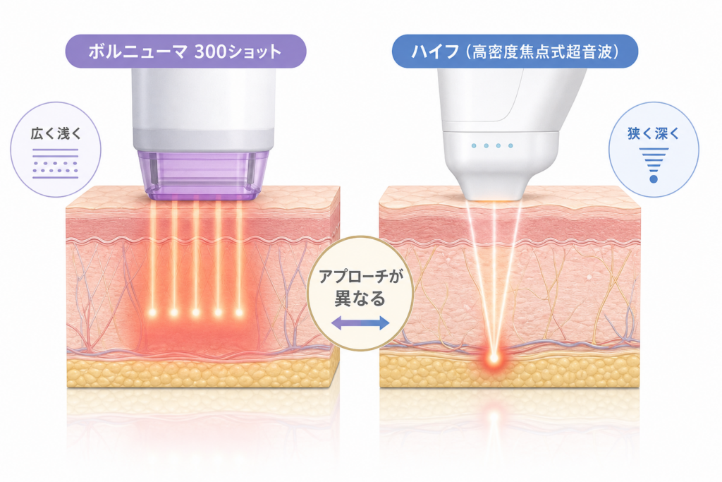 なぜボルニューマの300ショットはハイフとはアプローチが異なるのか