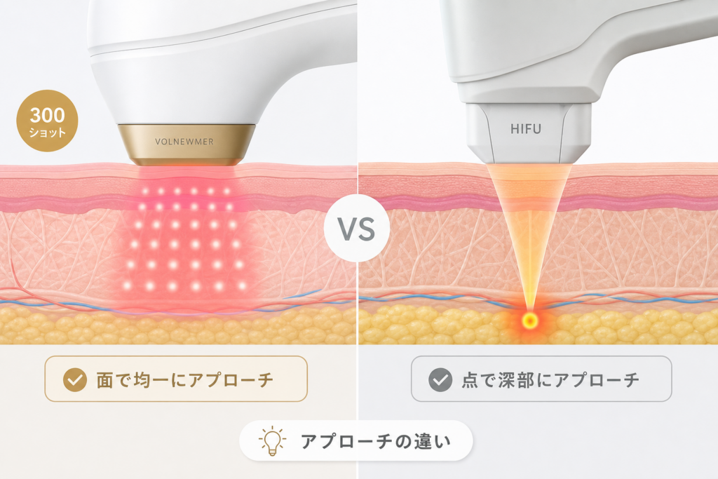 なぜボルニューマの300ショットはハイフとはアプローチが異なるのか