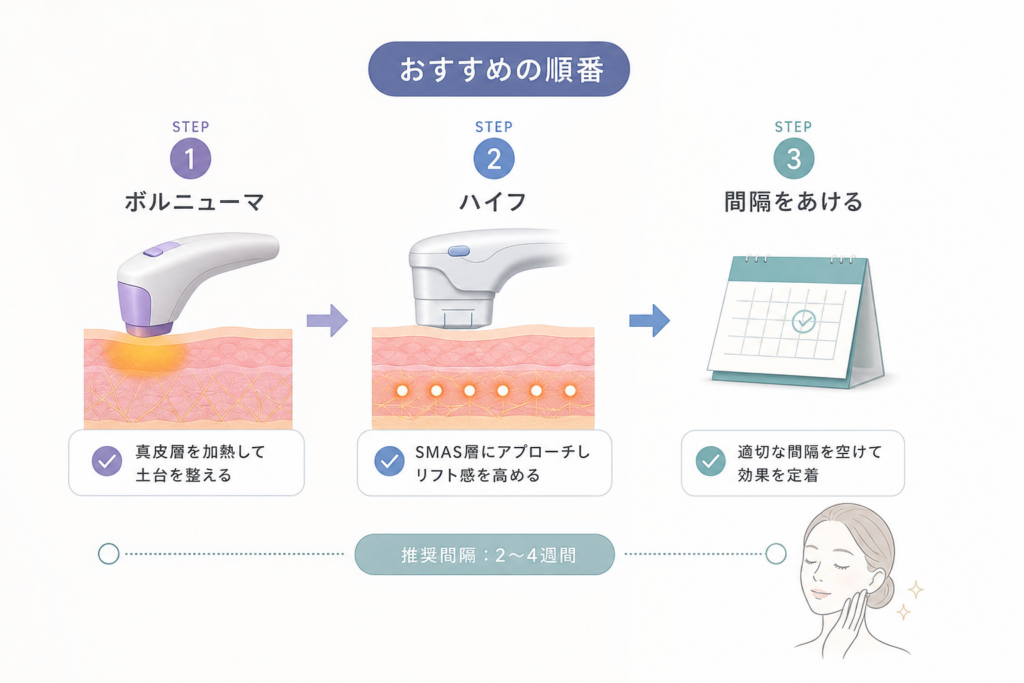 ボルニューマとハイフの併用で相乗効果を高める正しい順番と照射間隔