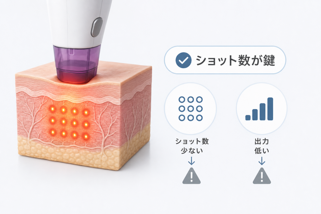 ボルニューマは効果ないという口コミに隠されたショット数と出力の盲点