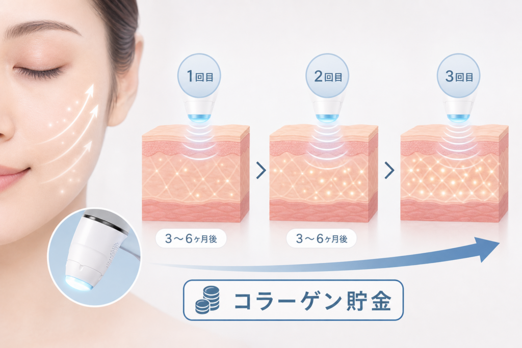 ボルニューマを3ヶ月から6ヶ月に1回の頻度で繰り返すとどうなる？継続によるコラーゲン貯金の仕組み