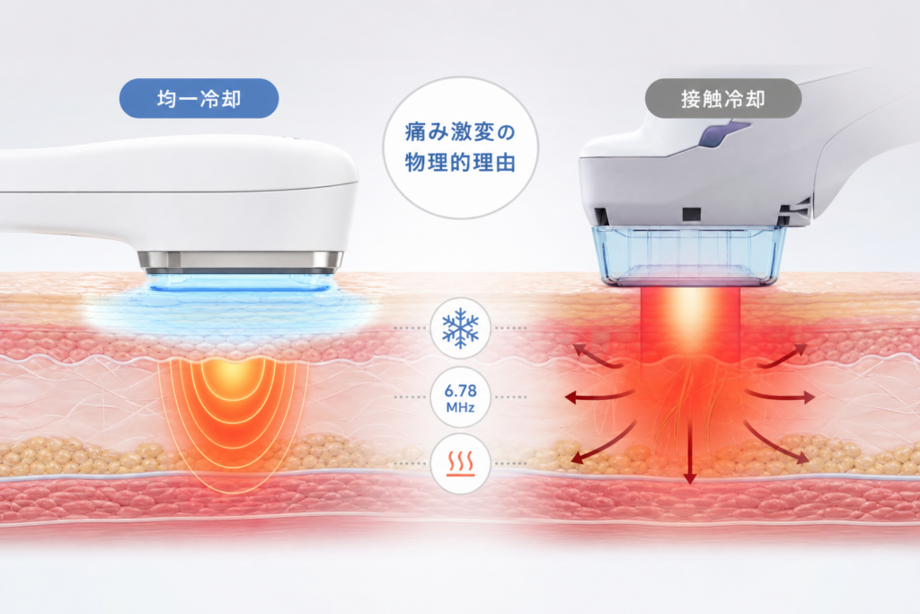 同じ6.78MHzなのに痛みが激変する物理的理由と冷却システムの構造