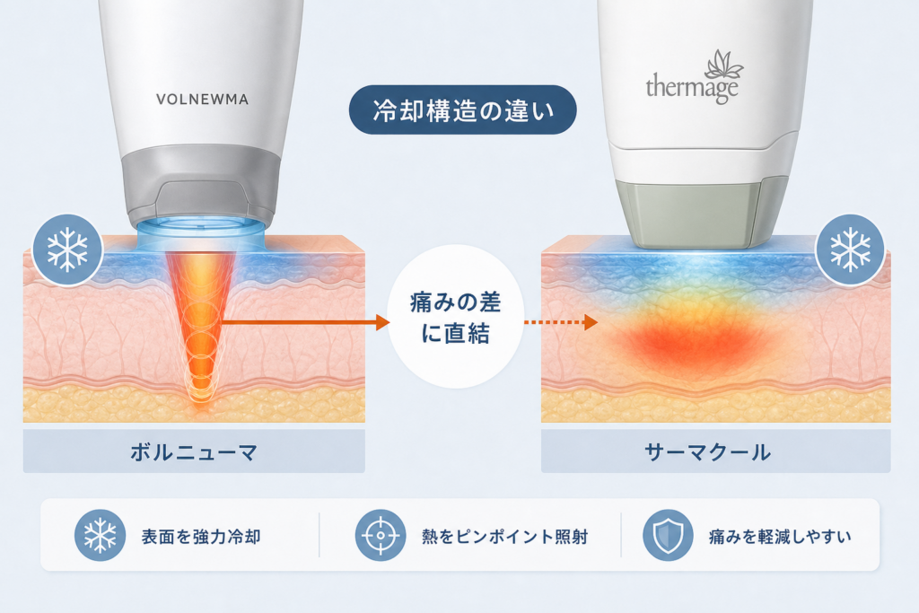 同じ6.78MHzなのに痛みが激変する物理的理由と冷却システムの構造