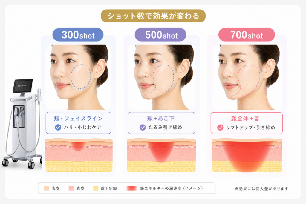 徹底比較！ボルニューマのショット数ごとの部位と効果の違いを大公開