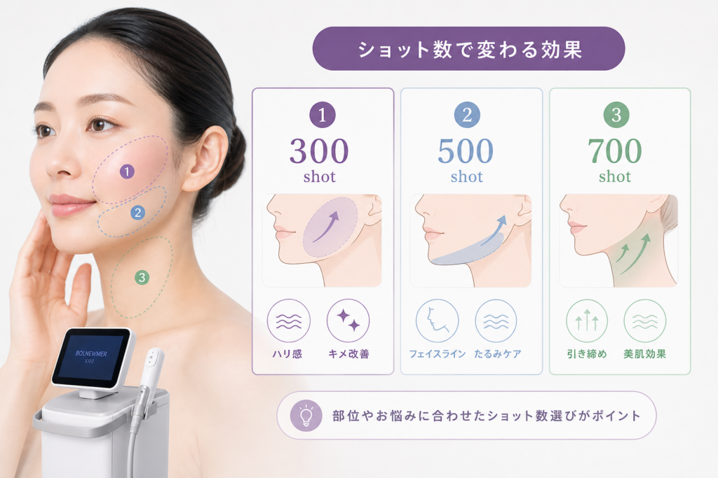 徹底比較！ボルニューマのショット数ごとの部位と効果の違いを大公開