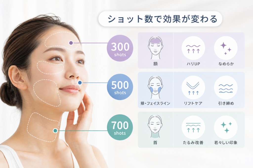 徹底比較！ボルニューマのショット数ごとの部位と効果の違いを大公開