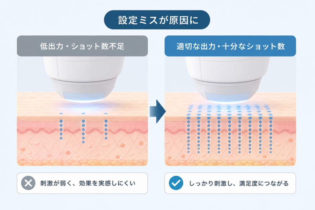 照射レベルやショット数の選択ミスが招く物足りなさの正体