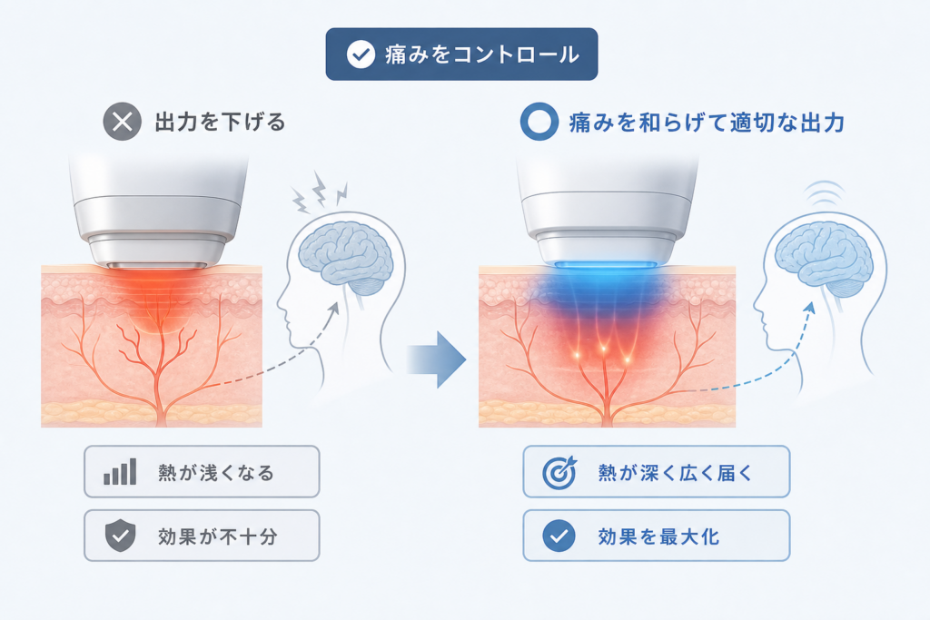 痛みで出力を下げると失敗する理由とゲートコントロール理論による解決策