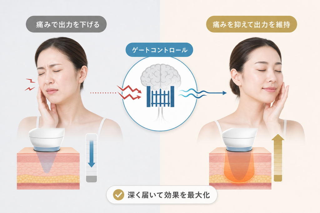 痛みで出力を下げると失敗する理由とゲートコントロール理論による解決策
