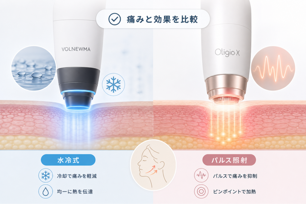 痛みと効果を比較:ボルニューマの水冷式とオリジオXのパルス照射