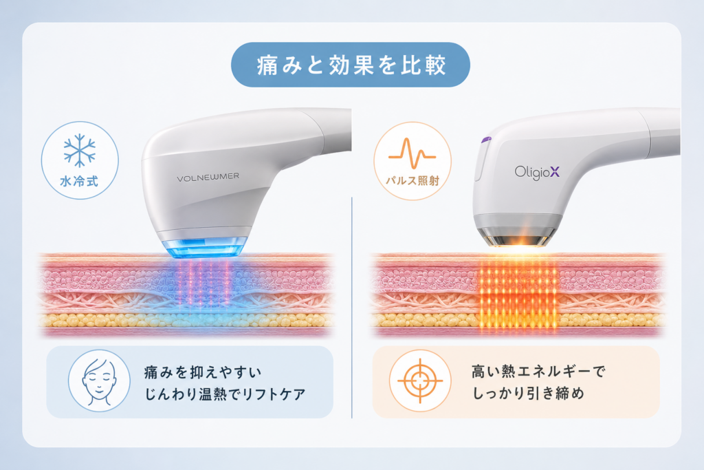 痛みと効果を比較:ボルニューマの水冷式とオリジオXのパルス照射